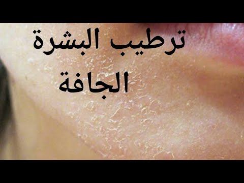 خلطات لجفاف الوجه-لازم نتعرف على خلطات نعملها فى وجهنا 6894 8