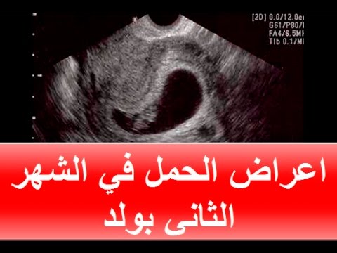 اعراض الحمل بولد طبيا - العلامات الطبية الدالة على ان المولود ذكرا 1031