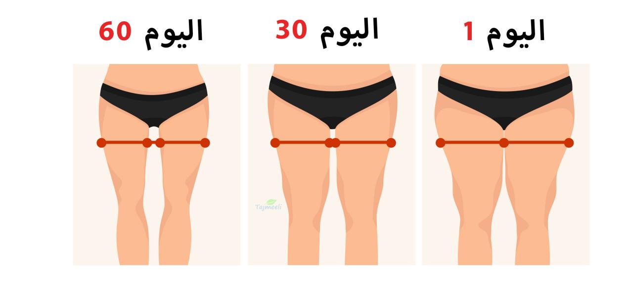 عملية شد الافخاذ , عمليات التجميل