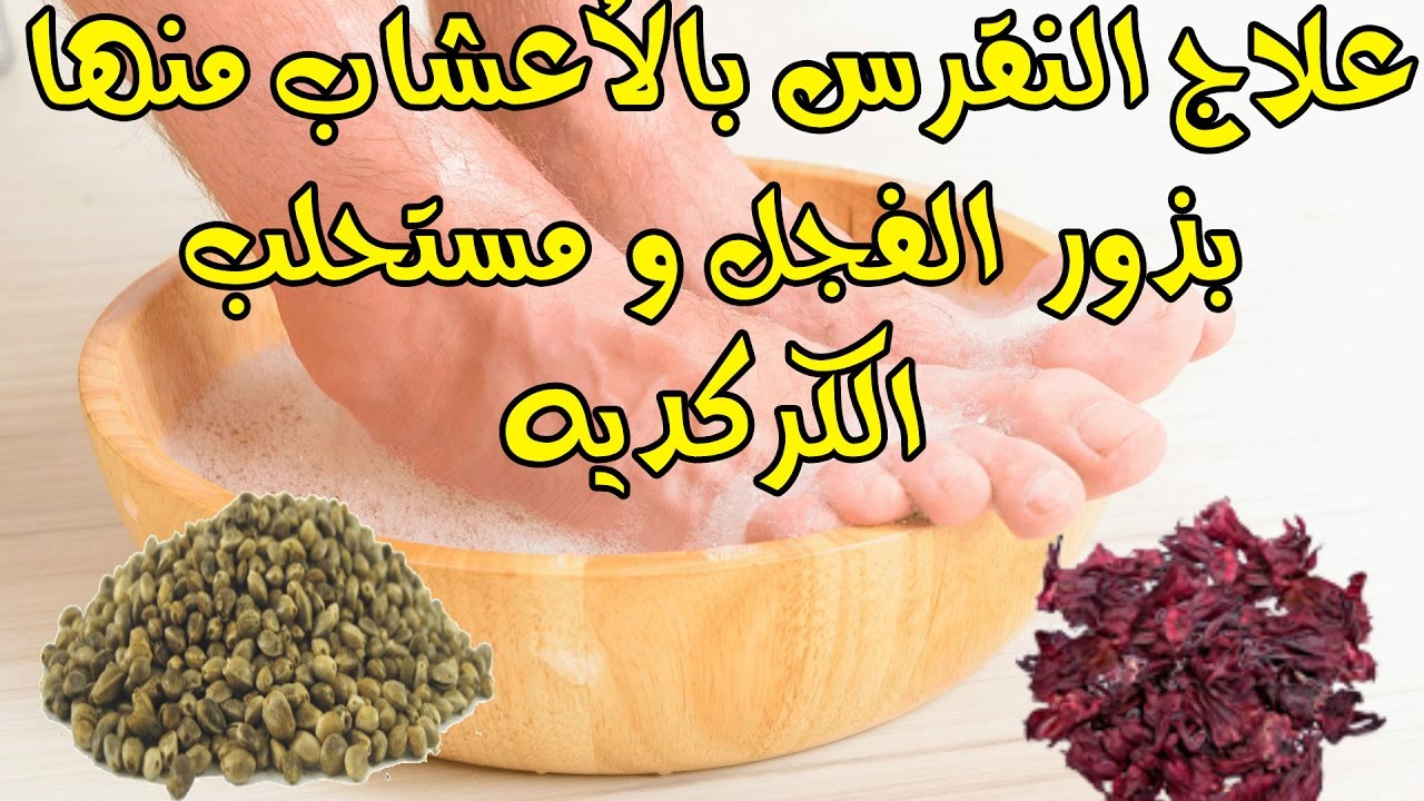 علاج النقرس السريع بالاعشاب , تعرفوا ان النقرس له علاج