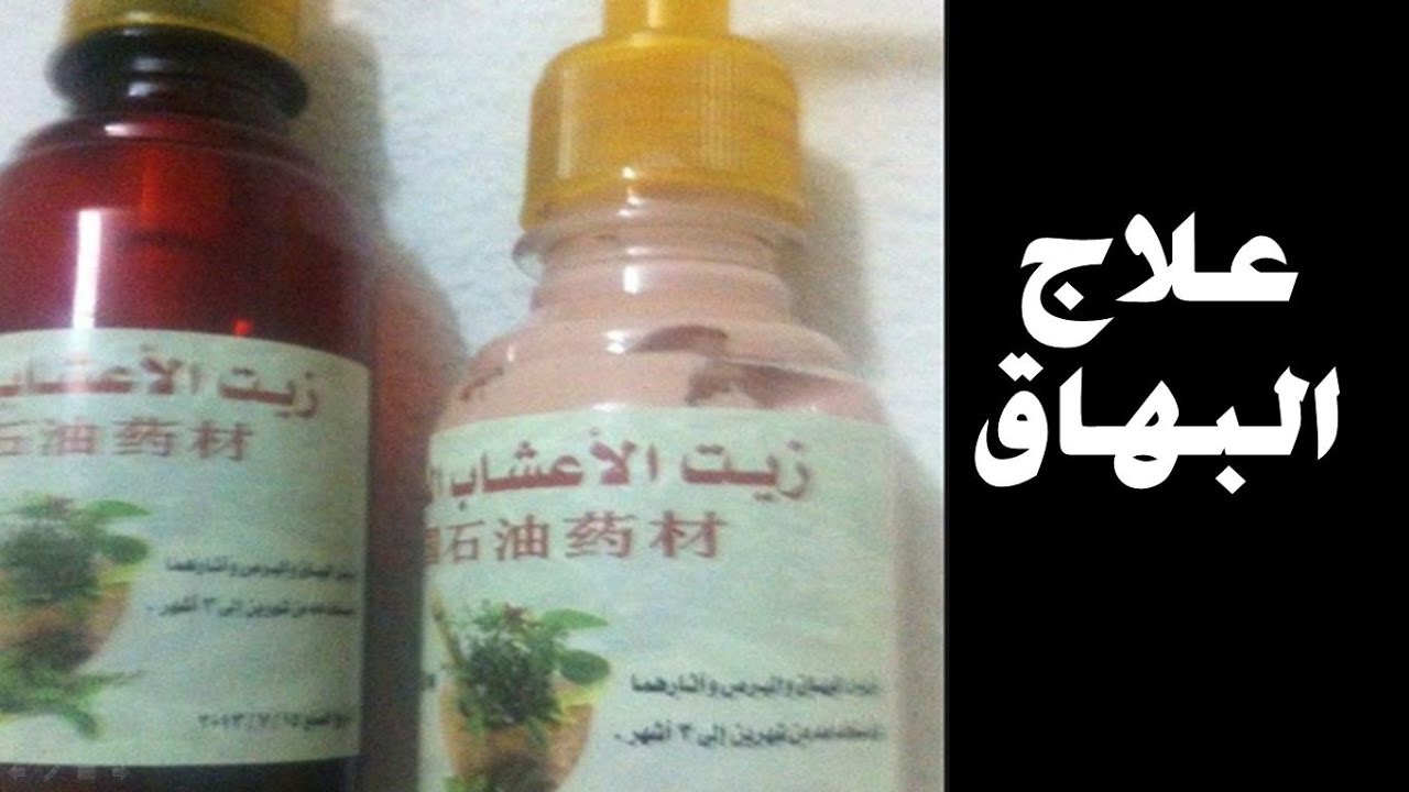 علاج البهاق بالاعشاب جابر القحطاني , اسهل واسرع علاج البهاق