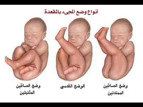 وضعية الجنين في الشهر السادس , كيف تكون وضعية الجنين فى الشهر السادس