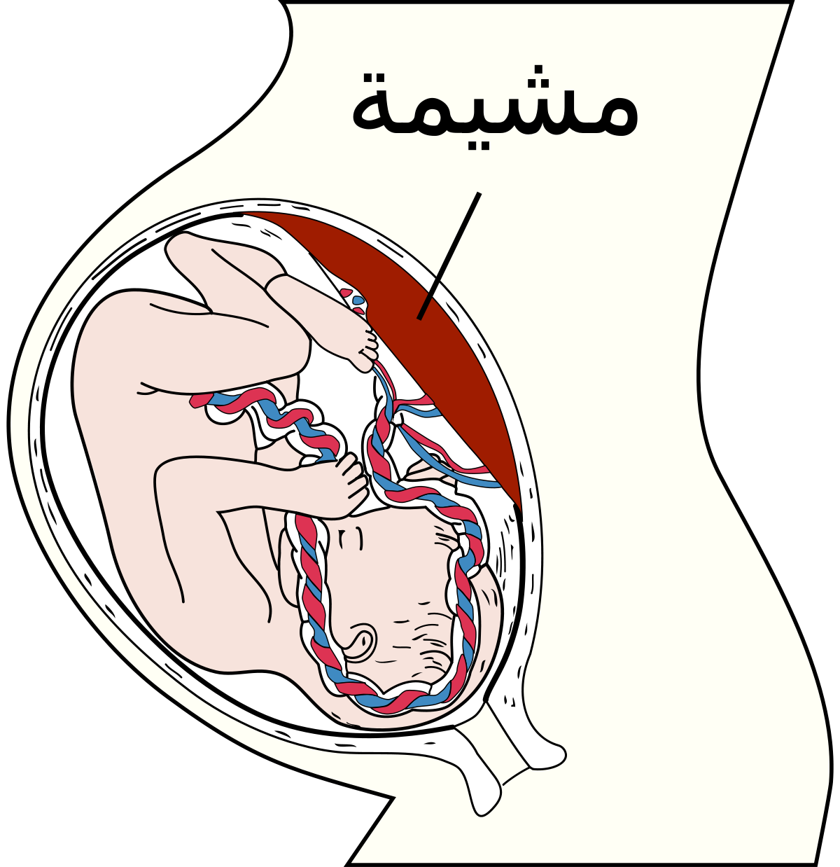 ما هي المشيمه عند الحامل - تعرف ما تكون المشيمه عند المراة الحامل 6343