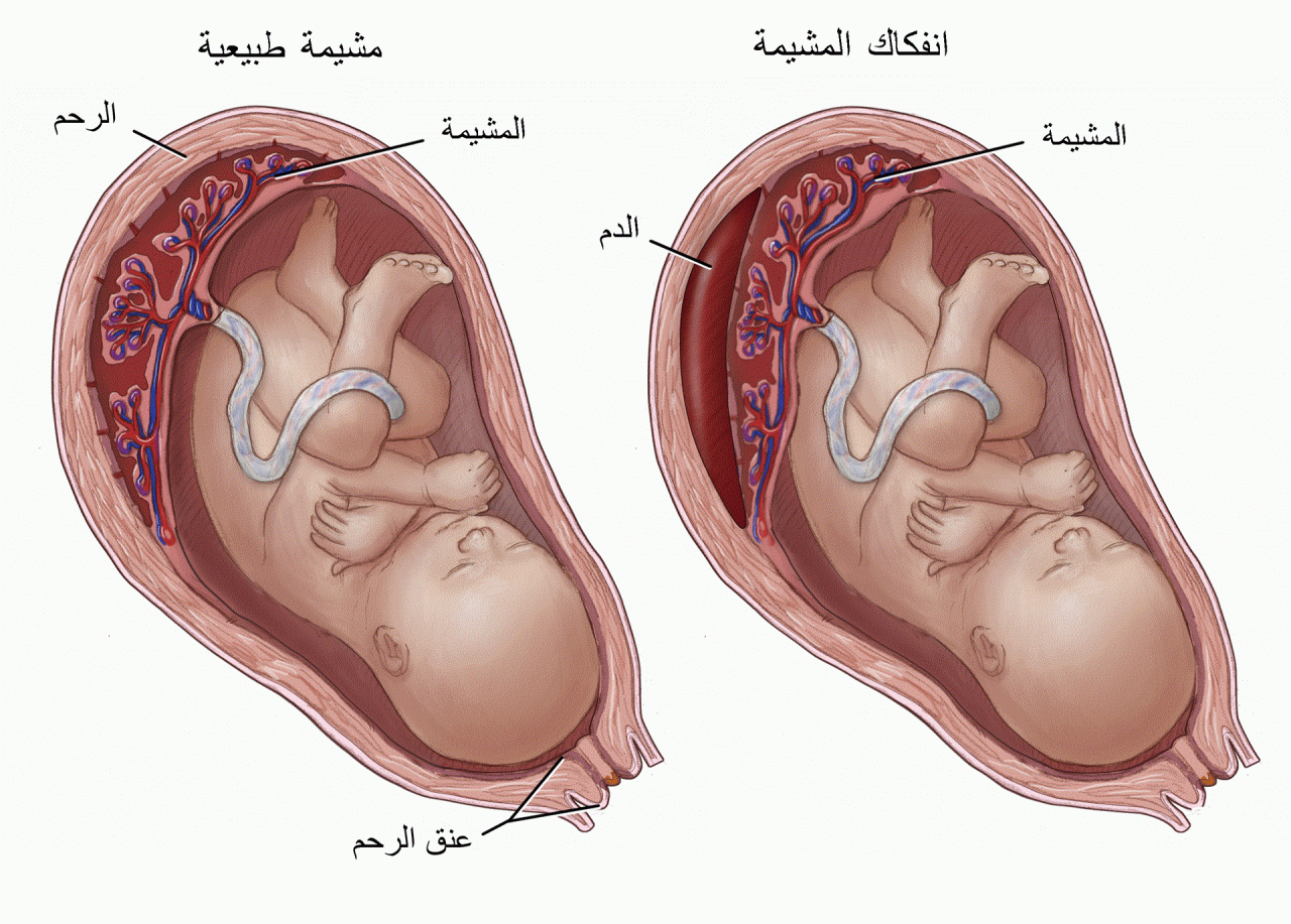 ما هي المشيمه عند الحامل - تعرف ما تكون المشيمه عند المراة الحامل 6343