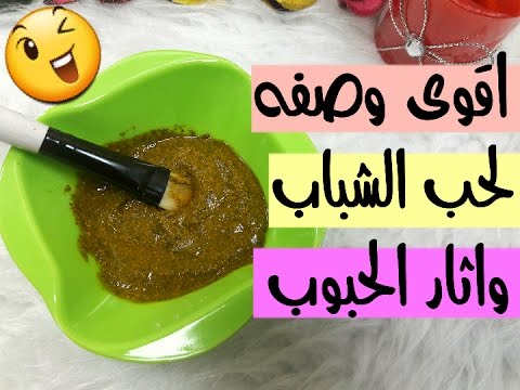 طريقة التخلص من حب الشباب في يوم واحد , ابسط طريقه لازم كل البنات تعرفها