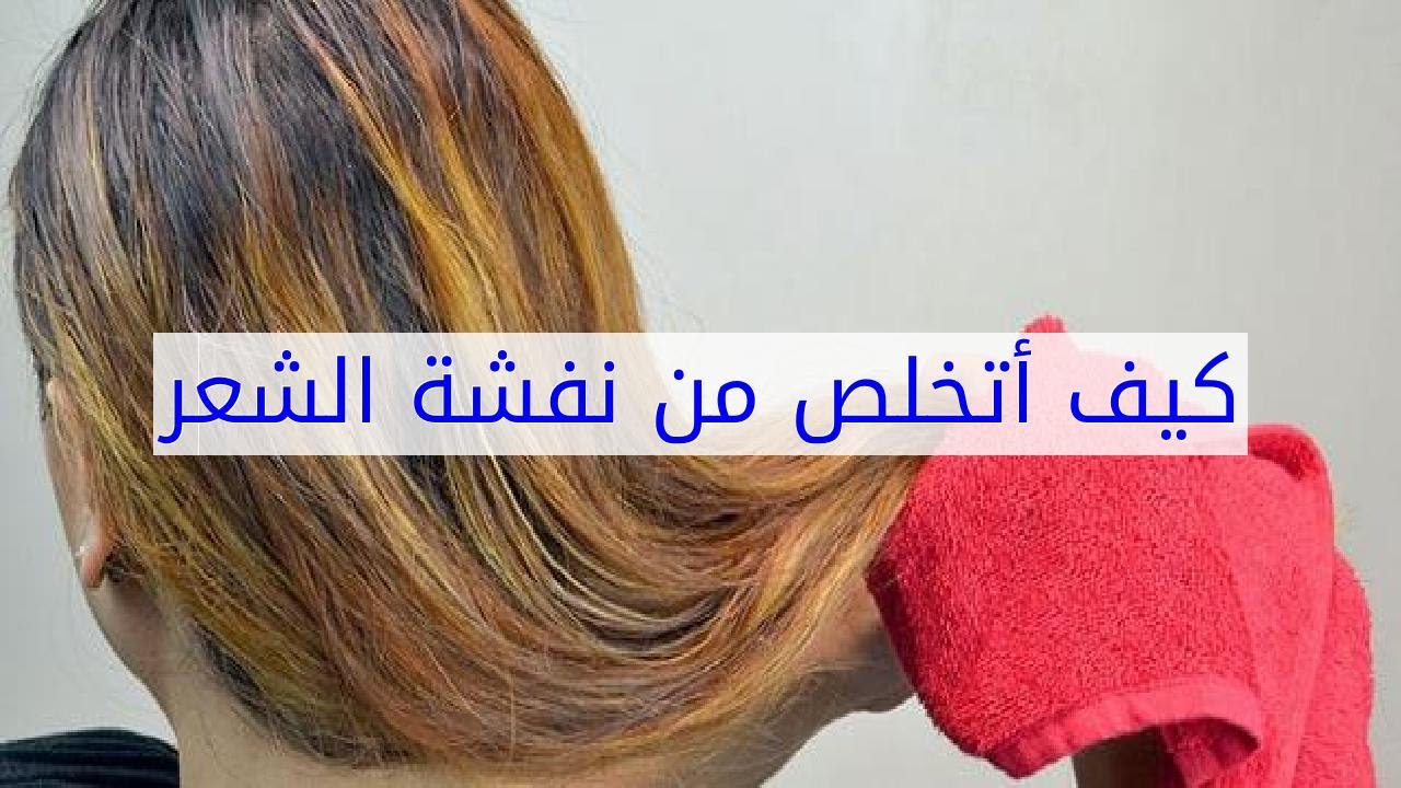 علاج نفشة الشعر , علاج هيشان الشعر