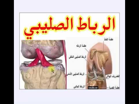 اعراض الرباط الصليبي - علامات واعراض الرباط الصليبي 623 8